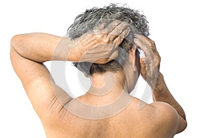 Old woman felt a lot of anxiety about hair loss and itching dandruff issue