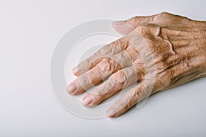 Old woman`s deform hands, Finger pain and stiffness from arthritis in senior people