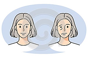 Old woman struggle with facial nerve palsy