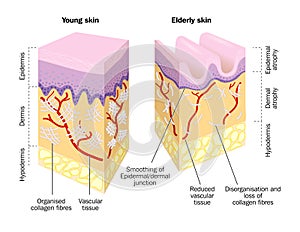 Old and Young Skin