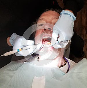 Older Man in Dentist Chair Getting Teeth Cleaned