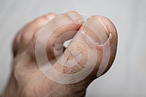 Older man feet fingers - dry skin - Shallow focus blur background