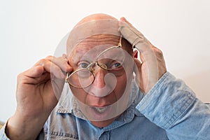 Older man with glasses cocked, bald, alopecia, chemotherapy, cancer, on white