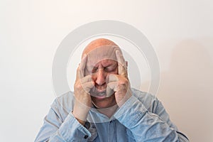 Older man hands to temples in pain, bald, alopecia, chemotherapy, cancer, isolated on white