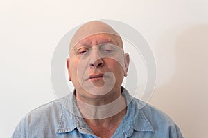 Older man head back with bad attitude, bald, alopecia, chemotherapy, cancer, on white