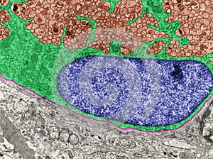 Olfactory nerve. False colour TEM micrograph photo