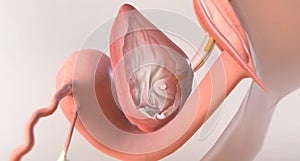 Once inside the urethra, the catheter advances several more inches toward the bladder
