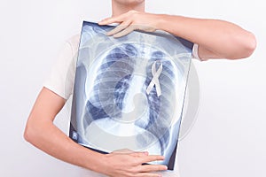 Oncological lung cancer disease concept photo