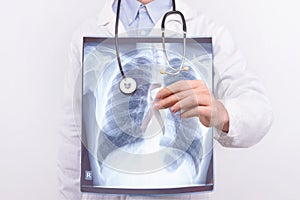 Oncological lung cancer disease concept photo