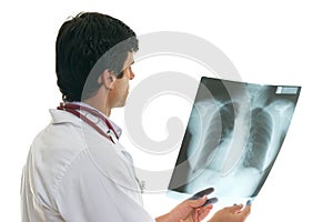 Oncologist with chest x-ray