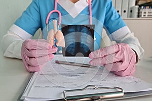 Oncologist doctor points to damaged area on x-ray of lungs