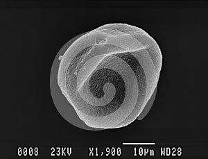 One hornbeam pollen grain scanning electron micrograph