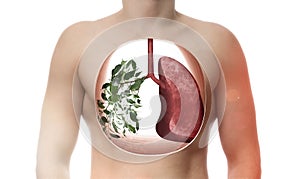 One lung consists of green leaves as metaphor healthy respiratory system