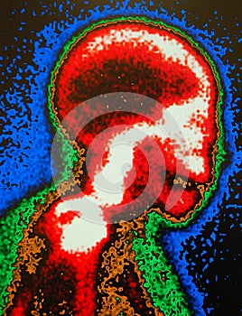 Nuclear medicine skull scan