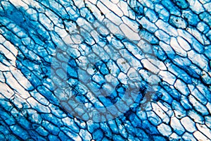 Onion cells at the microscope