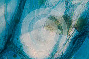 Onion cells at the microscope