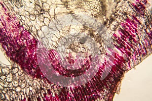 Onion cells at the microscope