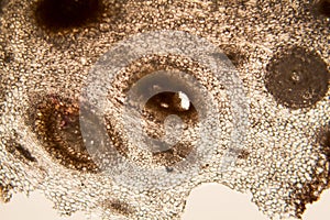 Onion root cells at the microscope