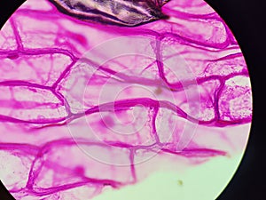 Onion skin viewed under microscope with pink stain