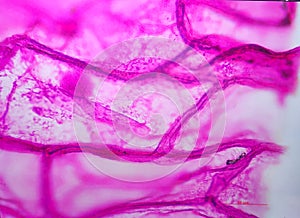 Onion skin viewed under microscope with pink stain