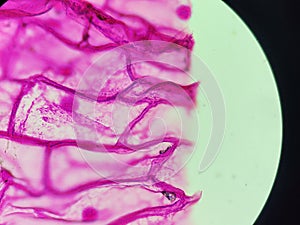 Onion skin viewed under microscope with pink stain