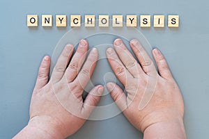 Onycholysis nail. The inscription Onycholysis in wooden letters on a gray background