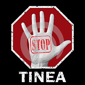 Open hand with the text stop tinea