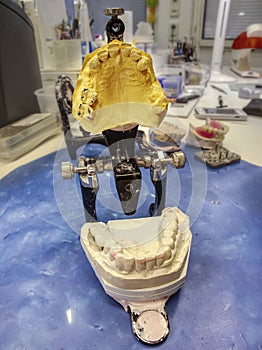 Open mouth articulator with teeth models in lab