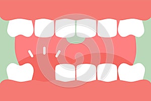 An open mouth with strong teeth and tongue and missing tooth