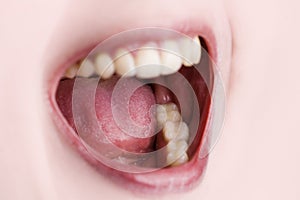 Open mouth and teeth