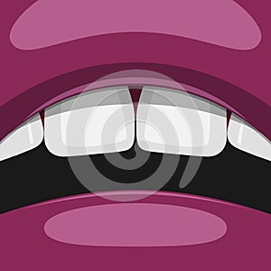 Open Mouth with white Teeth and purple Lips