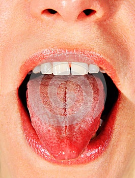 Opened mouth of woman
