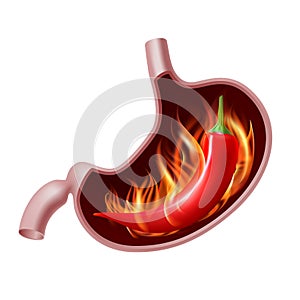 Opened Stomach with red pepper in fire. Spicy food gastritis.