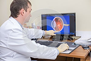 ophthalmologist at work points at computer