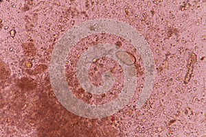 Opisthorchis viverini