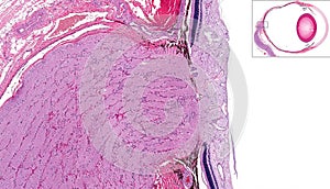 Optic nerve and retina photo