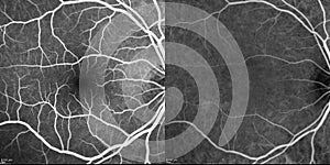Optical Coherence Tomography