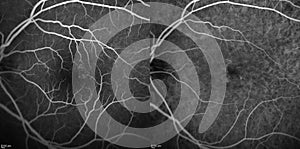 Optical Coherence Tomography photo