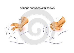 Options for indirect heart massage
