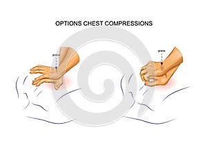 Options for indirect heart massage photo