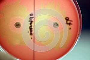 Optochin subsensitivity test on blood agar plate contains small