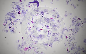 Oral cavity mucous membrane under the microscope