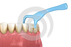 Oral hygiene: using toothpick dental floss to remove food stuck from teeth. Medically accurate dental 3D illustration