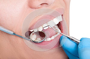 Oral hygienist at work photo