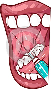 Oral and Maxillofacial Regional Anesthesia photo