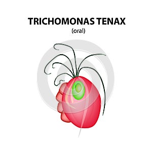 Oral Trichomonas structure. Trichomoniasis. Urogenital infection. Infographics. Vector illustration on isolated background. photo