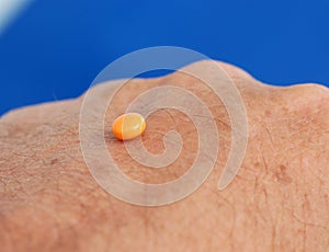 Orange pill on a palm