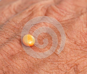 Orange pill on a palm