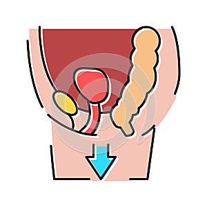 organ prolapse disease color icon vector illustration