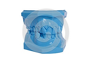 Orthodontic Blue Model used in dentistry for demonstration and educational purposes